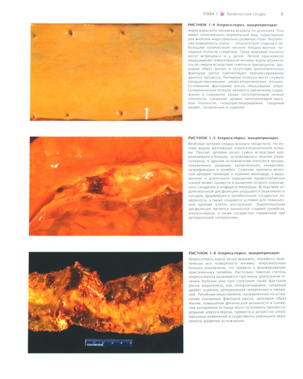 Атлас патологии Роббинса и Котрана