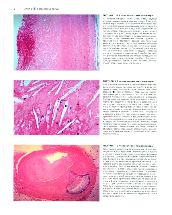 Атлас патологии Роббинса и Котрана