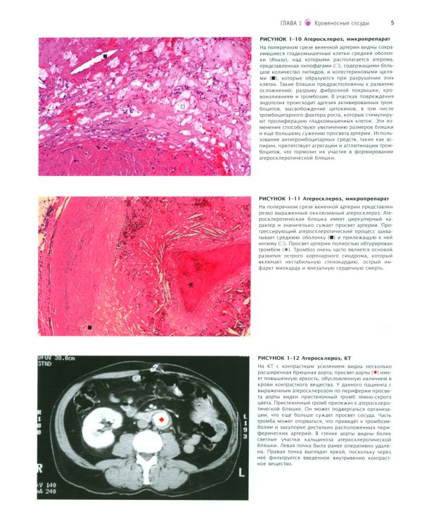 Атлас патологии Роббинса и Котрана