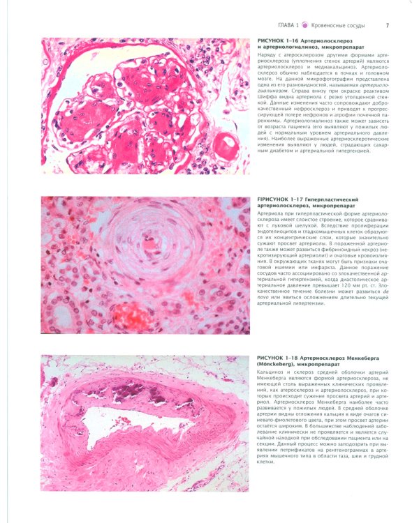 Атлас патологии Роббинса и Котрана