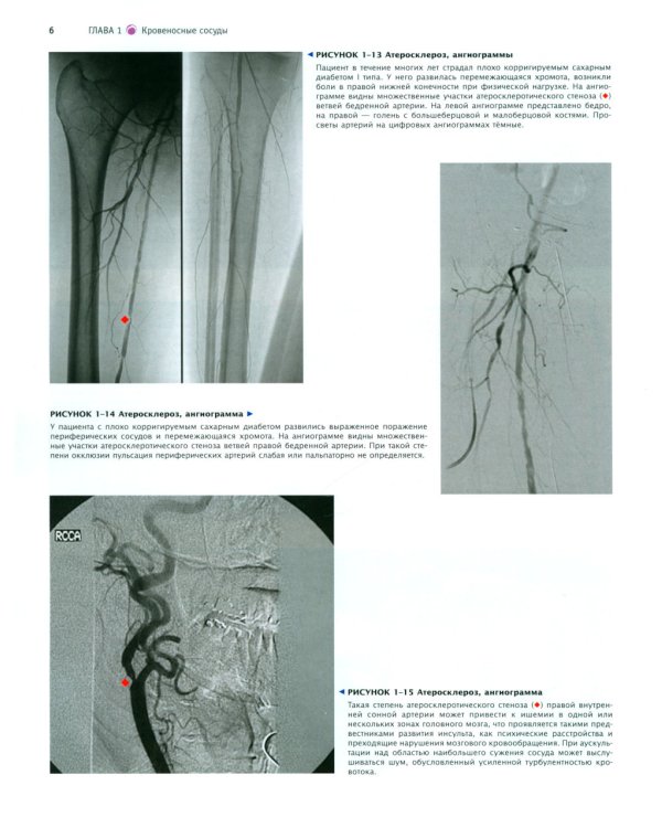 Атлас патологии Роббинса и Котрана