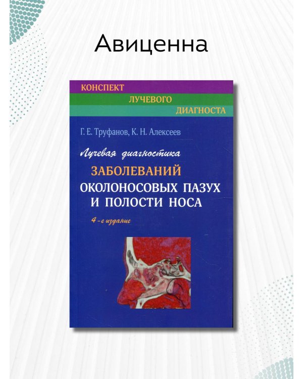 Лучевая диагностика заболеваний околоносовых пазух и полости носа