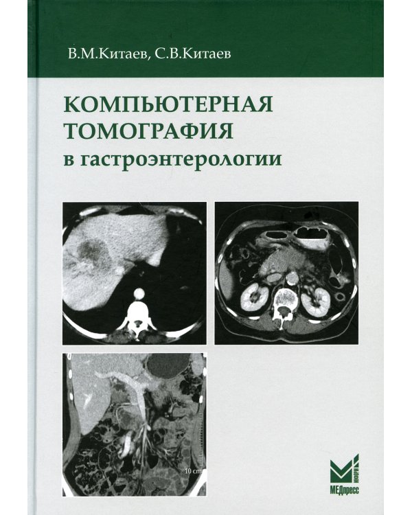 Компьютерная томография в гастроэнтерологии. 2-е изд