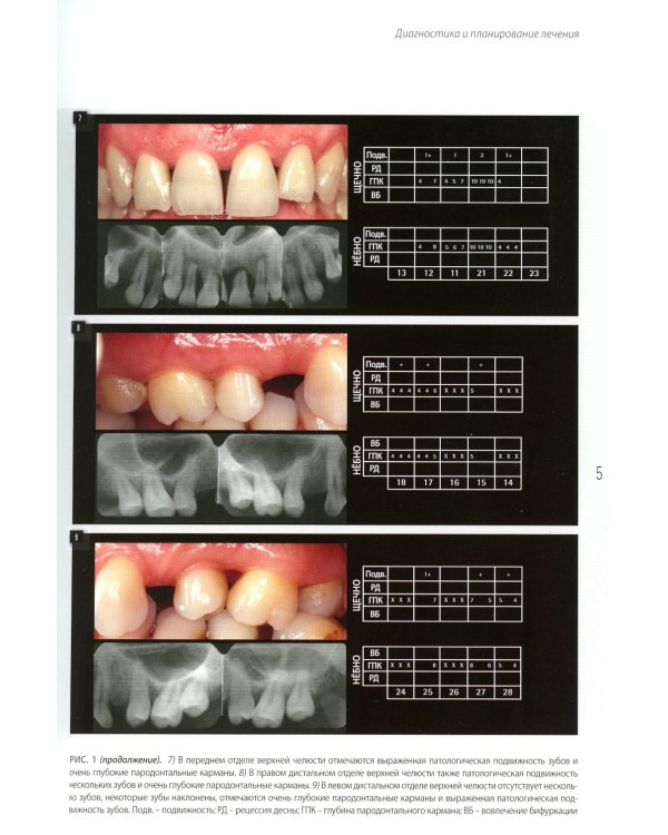 Диагностика и лечение заболеваний пародонта
