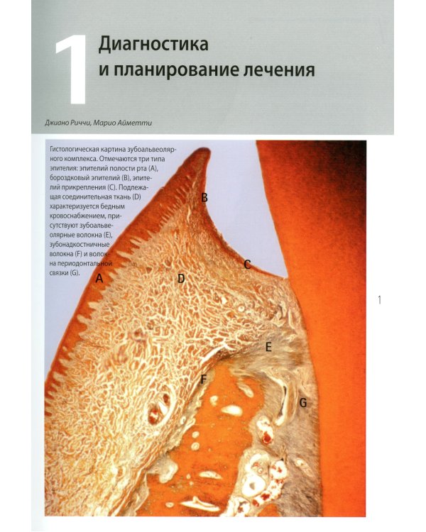 Диагностика и лечение заболеваний пародонта