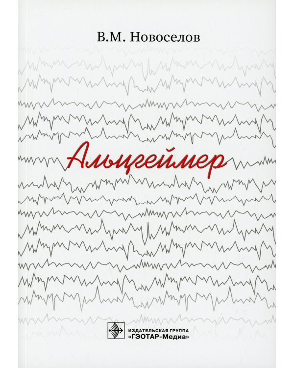 Альцгеймер