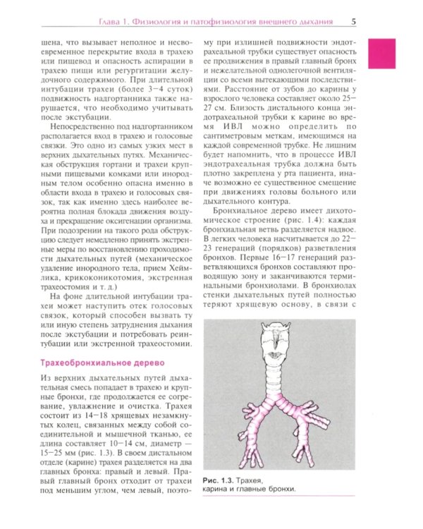 Механическая вентиляция легких