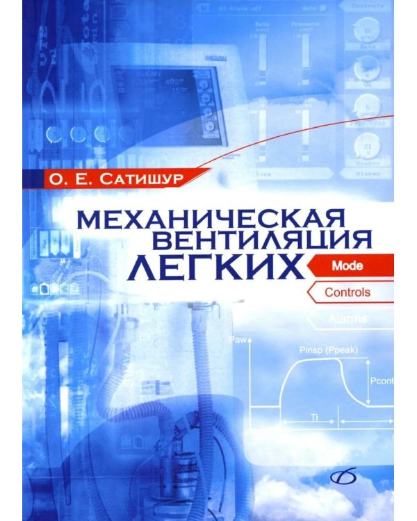 Механическая вентиляция легких