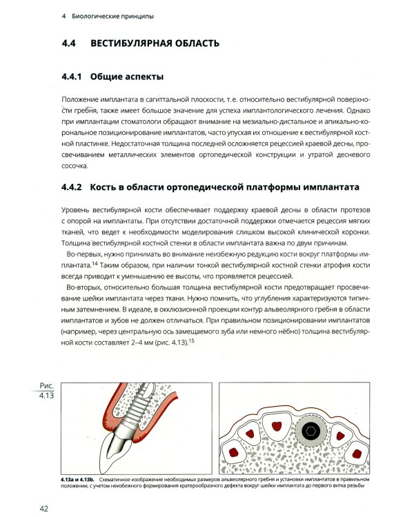 Имплантация в эстетически значимой зоне. Поэтапный алгоритм планирования лечения