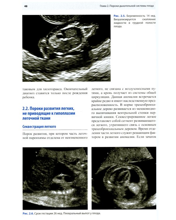 Ультразвуковая диагностика врожденных пороков развития плода