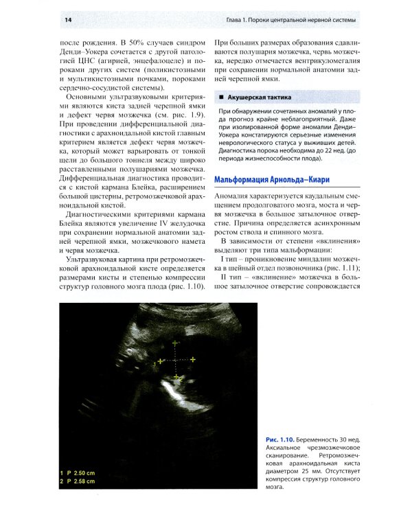 Ультразвуковая диагностика врожденных пороков развития плода