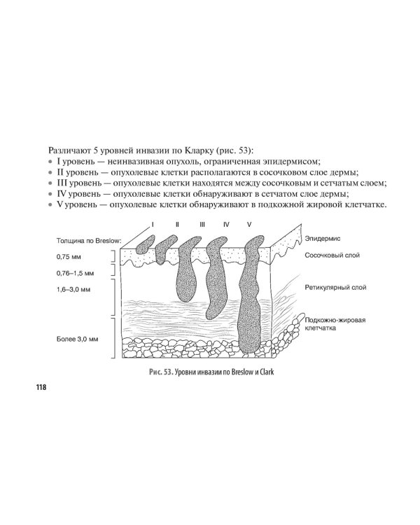 Рак кожи. Меланома: руководство для врачей