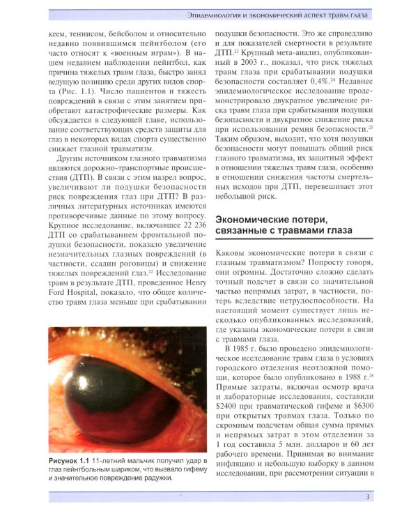 Травма глаза