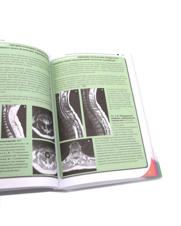 Топический диагноз в неврологии по Петеру Дуусу; Путеводитель по телу (комплект из 2-х книг)