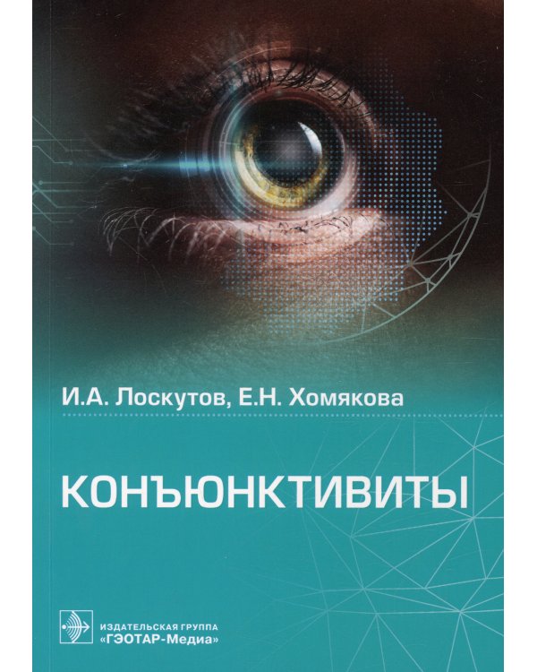 Конъюнктивиты