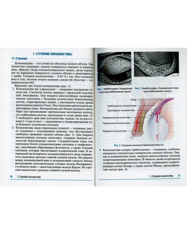 Конъюнктивиты