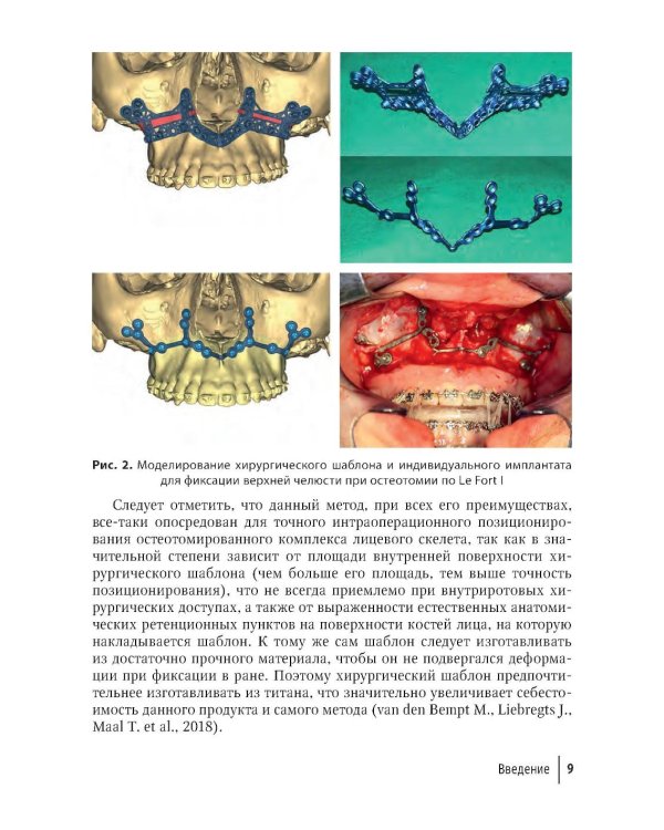 Компьютерная навигация и виртуальное планирование в ортогнатической и реконструктивной хирургии: руководство для врачей