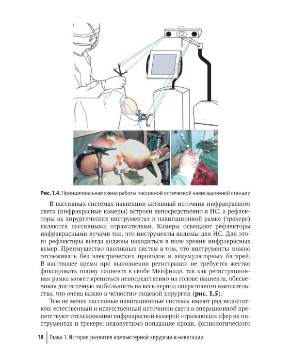 Компьютерная навигация и виртуальное планирование в ортогнатической и реконструктивной хирургии: руководство для врачей