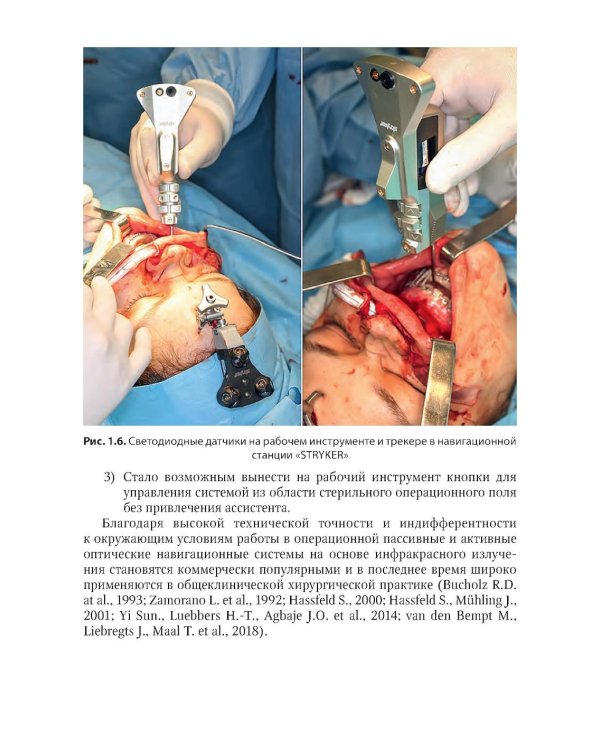 Компьютерная навигация и виртуальное планирование в ортогнатической и реконструктивной хирургии: руководство для врачей