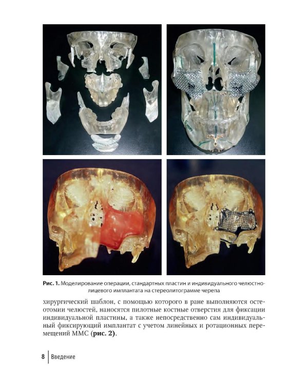 Компьютерная навигация и виртуальное планирование в ортогнатической и реконструктивной хирургии: руководство для врачей