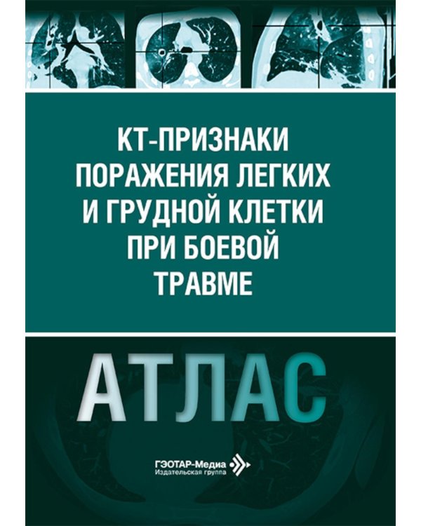 КТ-признаки поражения легких и грудной клетки при боевой травме: атлас