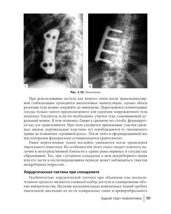 Техника и принципы хирургического лечения заболеваний и повреждений позвоночника: руководство для врачей. 2-е изд., доп.и перераб