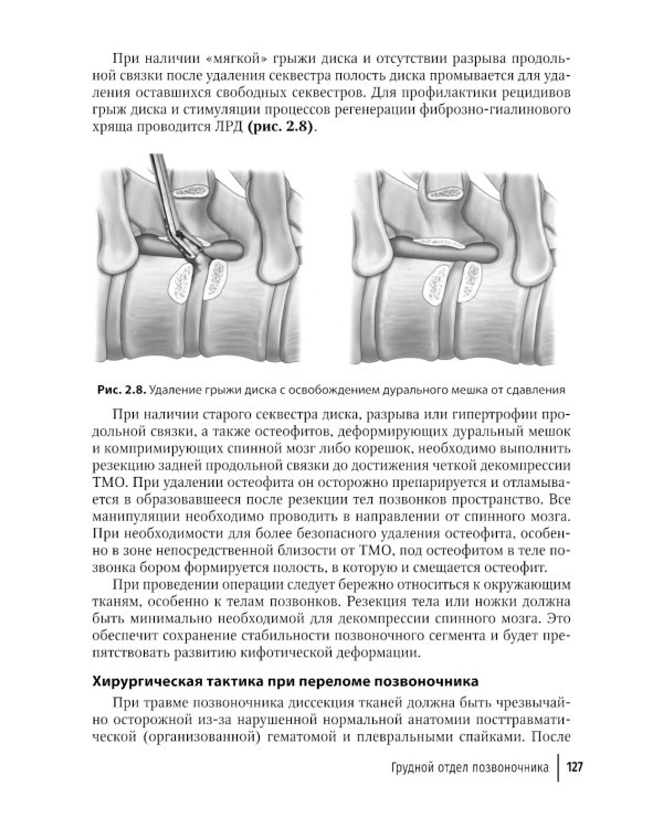 Техника и принципы хирургического лечения заболеваний и повреждений позвоночника: руководство для врачей. 2-е изд., доп.и перераб