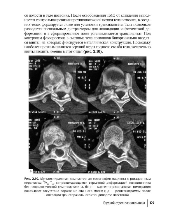 Техника и принципы хирургического лечения заболеваний и повреждений позвоночника: руководство для врачей. 2-е изд., доп.и перераб