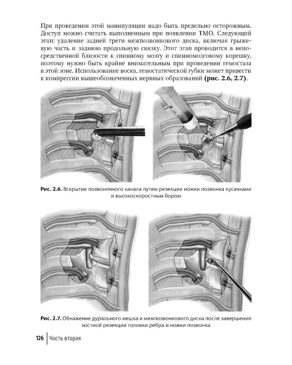 Техника и принципы хирургического лечения заболеваний и повреждений позвоночника: руководство для врачей. 2-е изд., доп.и перераб