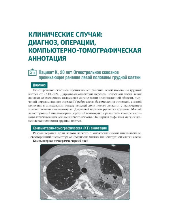 КТ-признаки поражения легких и грудной клетки при боевой травме: атлас