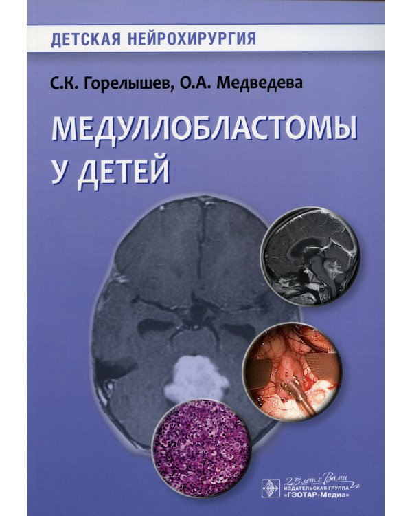 Медуллобластомы у детей