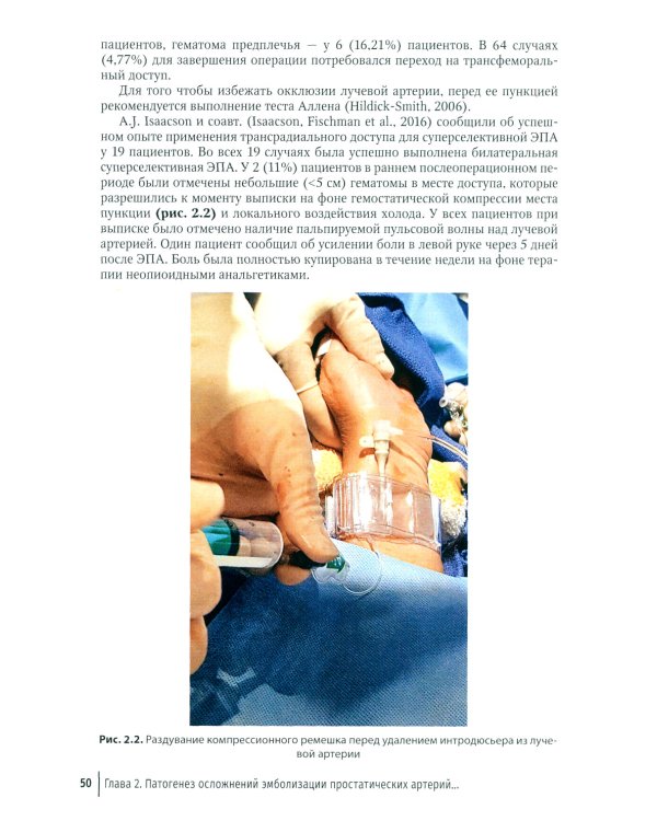 Эмболизация простатических артерий в лечении доброкачественной гиперплазии предстательной железы: руководство для врачей