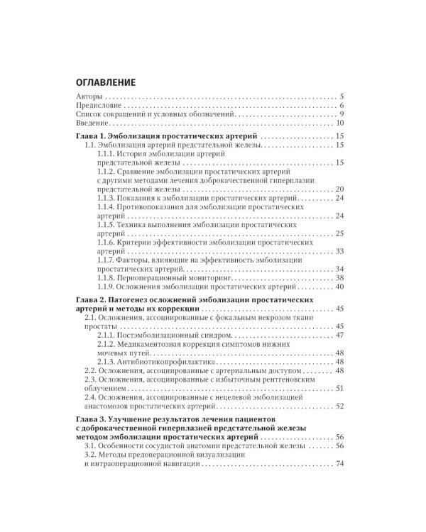 Эмболизация простатических артерий в лечении доброкачественной гиперплазии предстательной железы: руководство для врачей