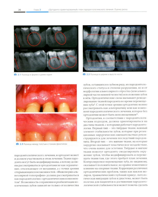 Ортодонтия и пародонтология. Комбинированные стратегии лечения