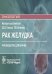 Рак желудка: руководство для врачей