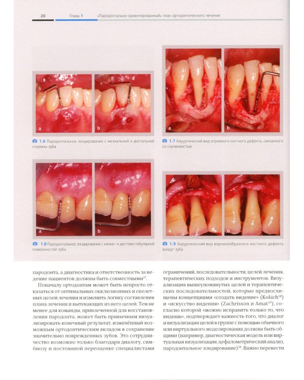 Ортодонтия и пародонтология. Комбинированные стратегии лечения