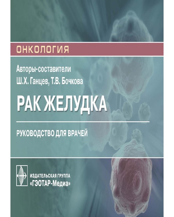 Рак желудка: руководство для врачей