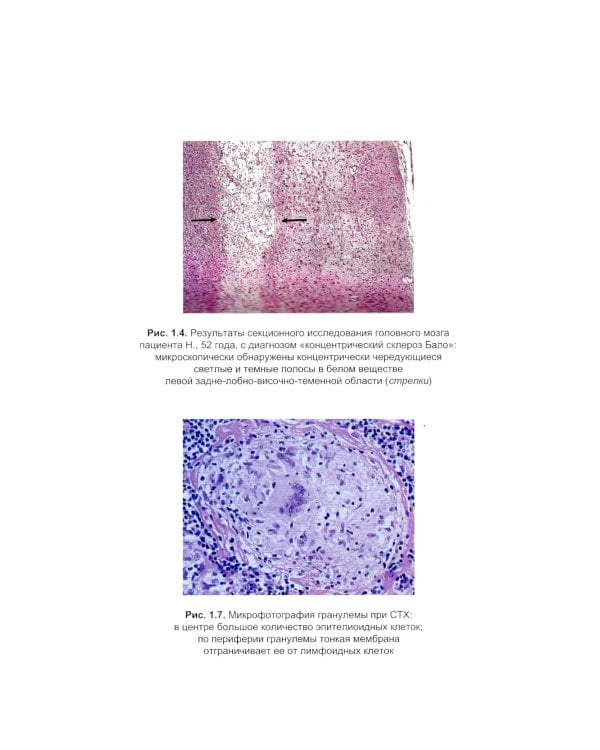 Редкие клинические случаи в неврологии (случаи из практики): Руководство для врачей