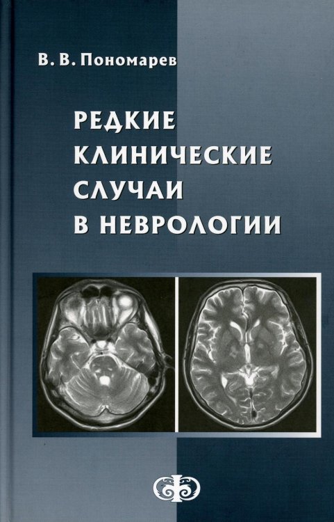 Редкие клинические случаи в неврологии (случаи из практики): Руководство для врачей
