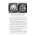 Редкие клинические случаи в неврологии (случаи из практики): Руководство для врачей