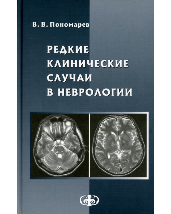 Редкие клинические случаи в неврологии (случаи из практики): Руководство для врачей