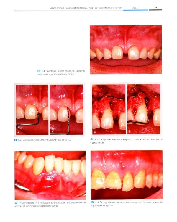 Ортодонтия и пародонтология. Комбинированные стратегии лечения