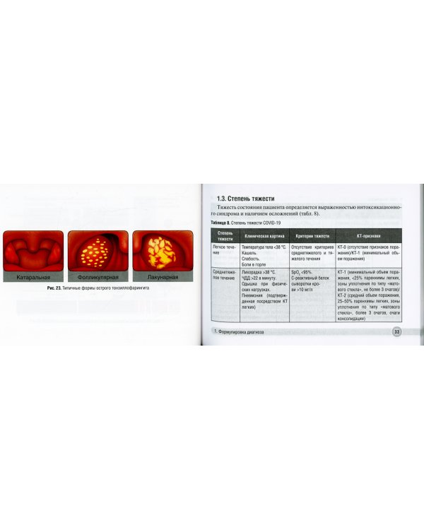 Острые респираторные вирусные инфекции