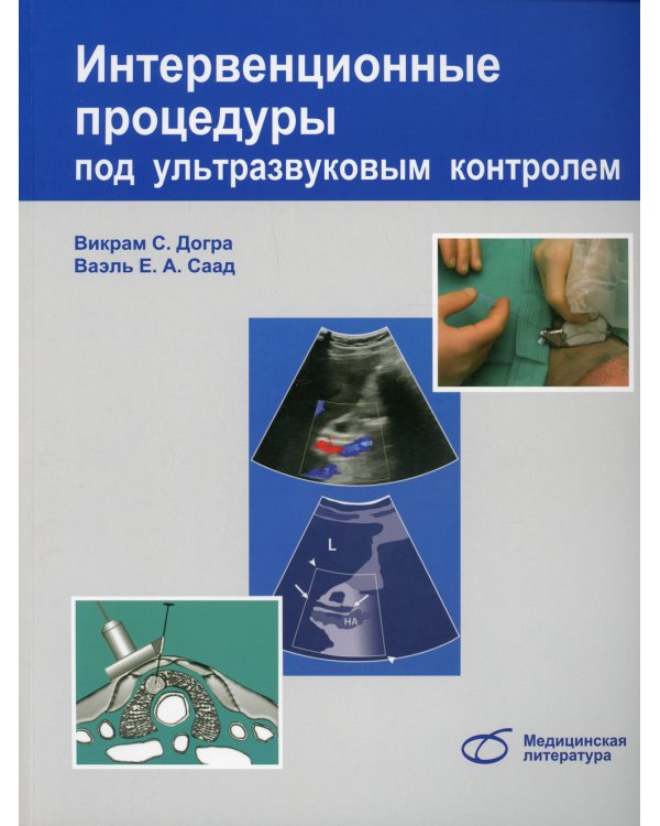 Интервенционные процедуры под ультразвуковым контролем