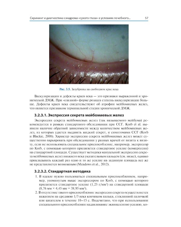 Синдром «сухого глаза»: практический подход