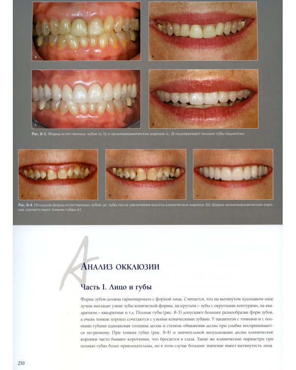 Междисциплинарное планирование стоматологического лечения. Принципы, цели, практическое применение. Иллюстрированные лекции