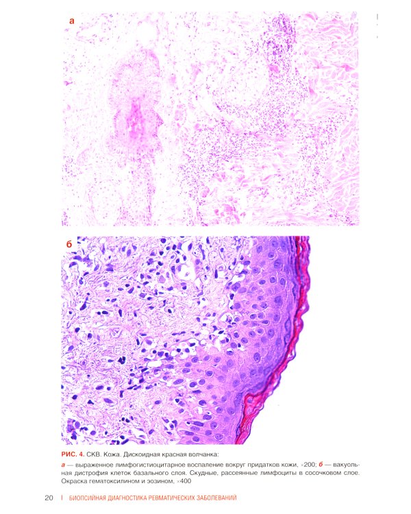 Биопсийная диагностика ревматических заболеваний. Руководство для врачей