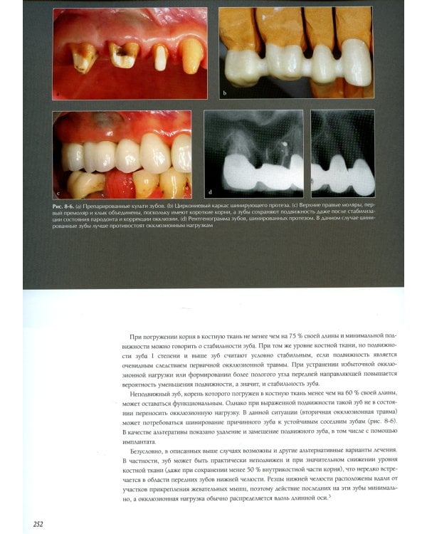 Междисциплинарное планирование стоматологического лечения. Принципы, цели, практическое применение. Иллюстрированные лекции