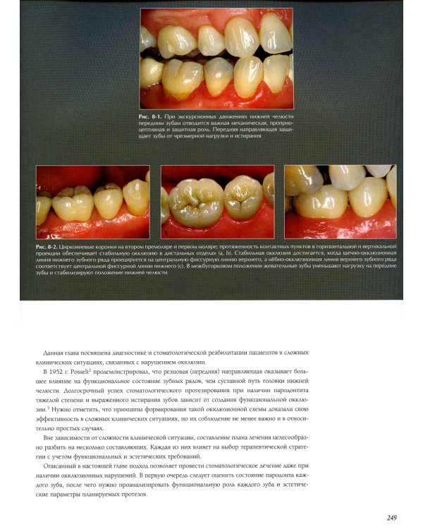 Междисциплинарное планирование стоматологического лечения. Принципы, цели, практическое применение. Иллюстрированные лекции