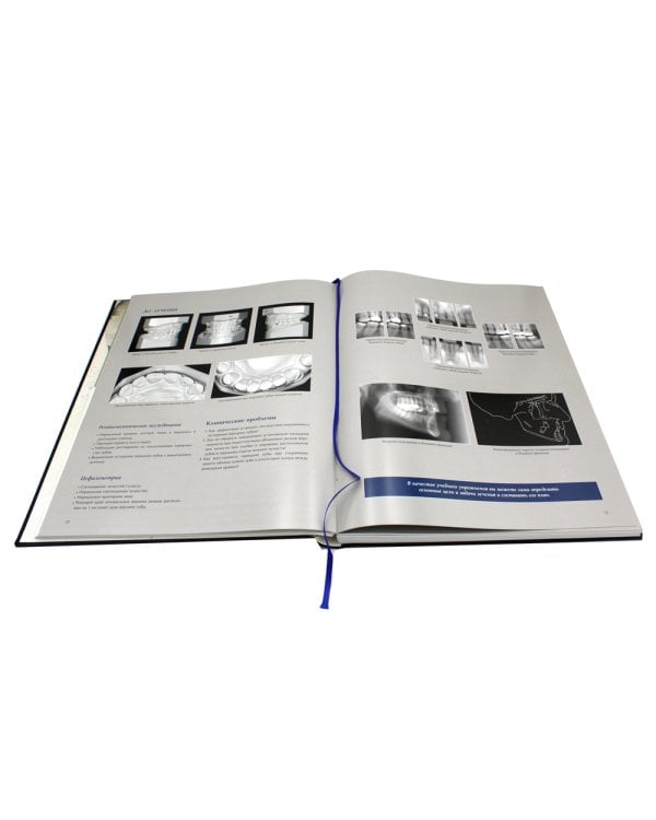 Междисциплинарное планирование стоматологического лечения. Принципы, цели, практическое применение. Иллюстрированные лекции